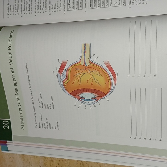 Study Guide for Lewis's Medical-Surgical Nursing 11th Edition - Picture 3 of 5